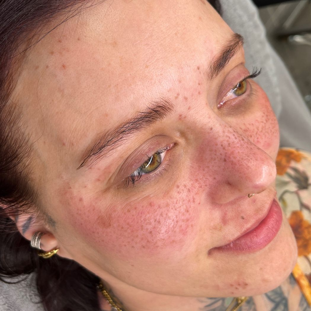Sommersprossen Permanent Make-Up bei Aesthetik by Ina Zierhut